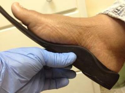 Dr. Sables holds up a custom orthotic to show how it matches up to the patient's arch.