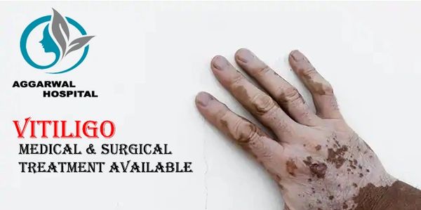 For Vitiligo, surgical options are available when medications and light therapy are not effective. A