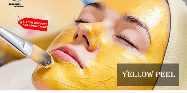 Yellow peel skin treatment is a progressive peel, whose effects depend on the number of applied laye