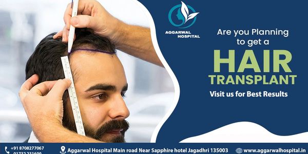 1. Follicular Unit Transplantation (FUT) 
Also known as the strip method, this hair transplant proce