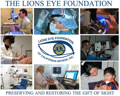 The Santa Cruz Host Lions Club is a member club of the Lions Eye Foundation of California-Nevada.
