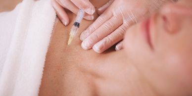 L'injection de PRP dans la peau permet, en particulier, de stimuler le processus de microvascularisa