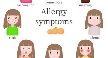 Symptoms of allergy include itchy eyes, runny nose, sneezing, nasal congestion, cough, sinus problem