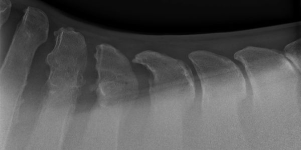Equine thoracolumbar (back) Remodeling; Kissing spine remodeling 