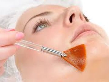 Chemical peel