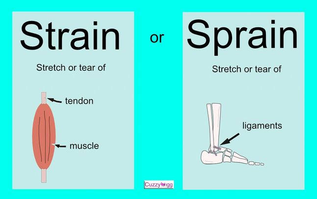 Strain or sprain? Cuzzywigg