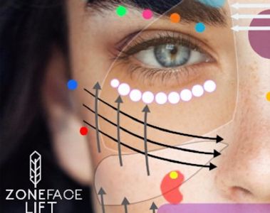 zonefacelift online
