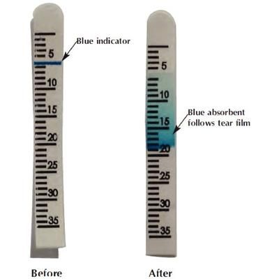 Dri-I Schirmer Test 100/Box , JORGENSEN J1192B