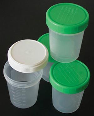 Specimen Cup with lid, 4 oz, 500/cs , ADI Medical 2-122