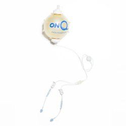 ON-Q Pain Relief System, Dual Silversoaker Antimicrobial Catheters (5" or 12.5cm), 270ml, 4 ml/hr (2ml/hr + 2ml/hr), 26.5" Catheter Length Pump, 5/cs , Avanos PM025-A