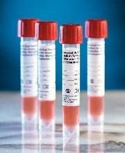 Universal Viral Transport Kit Includes: 3mL Vial with Regular Flocked Swab, 50/pk , BD 220528