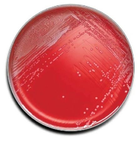 Phenylethyl Alcohol Agar with 5% Sheep Blood, 200/Case , BD 221179