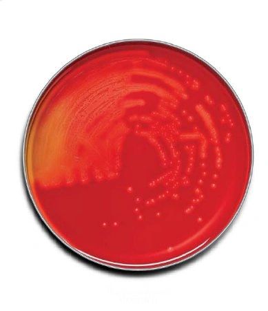 Trypticase Soy Agar with 5% Sheep Blood (TSA II) Dark Red Plate, 100/Case , BD 221261