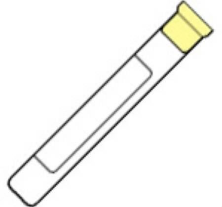 BD Vacutainer Venous Blood Collection Tube Whole Blood ACD Solution B Additive 13 X 100 mm 6 mL Yellow Conventional Closure Glass Tube , 100/Box , 10 Box/Case , BD 364816
