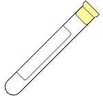 BD Vacutainer Venous Blood Collection Tube Whole Blood Sodium Polyanethol Sulfonate Additive 16 X 100 mm 8.3 mL Yellow Conventional Closure Glass Tube , 1000/Case , BD 364960