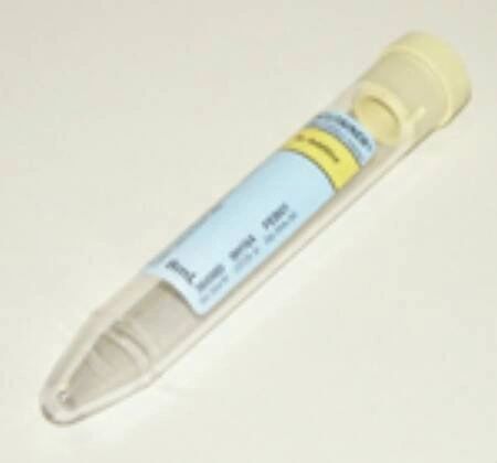 BD Vacutainer, Urinalysis Tube Conical Bottom Plain 16 X 100 mm 8 mL Yellow Conventional Closure Plastic Tube, 100/Box , 10 Box/Case , BD 364980