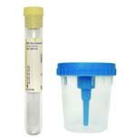 Urine Collection Kit BD Vacutainer Sterile 50 /Box , BD 364981