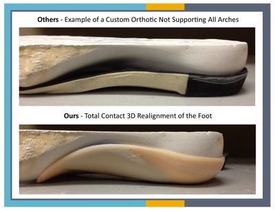 The ArchMaters Orthotics are made from a mold of your feet.