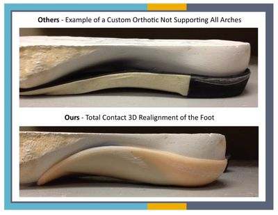 ArchMasters - Custom Molded Orthotics, Custom AFO