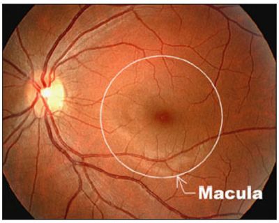 Mohawk Valley Retina - Macular Degeneration - New Hartford, New York