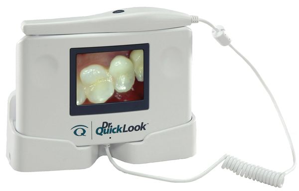 Dr QuickLook Dental Viewer Intraoral Viewer