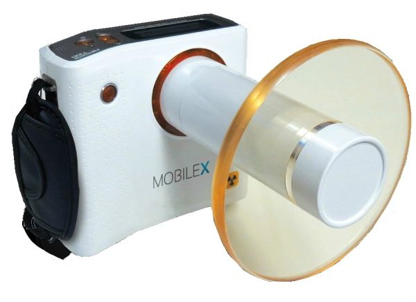 Mobile-X Portable Handheld Dental X-Ray Unit