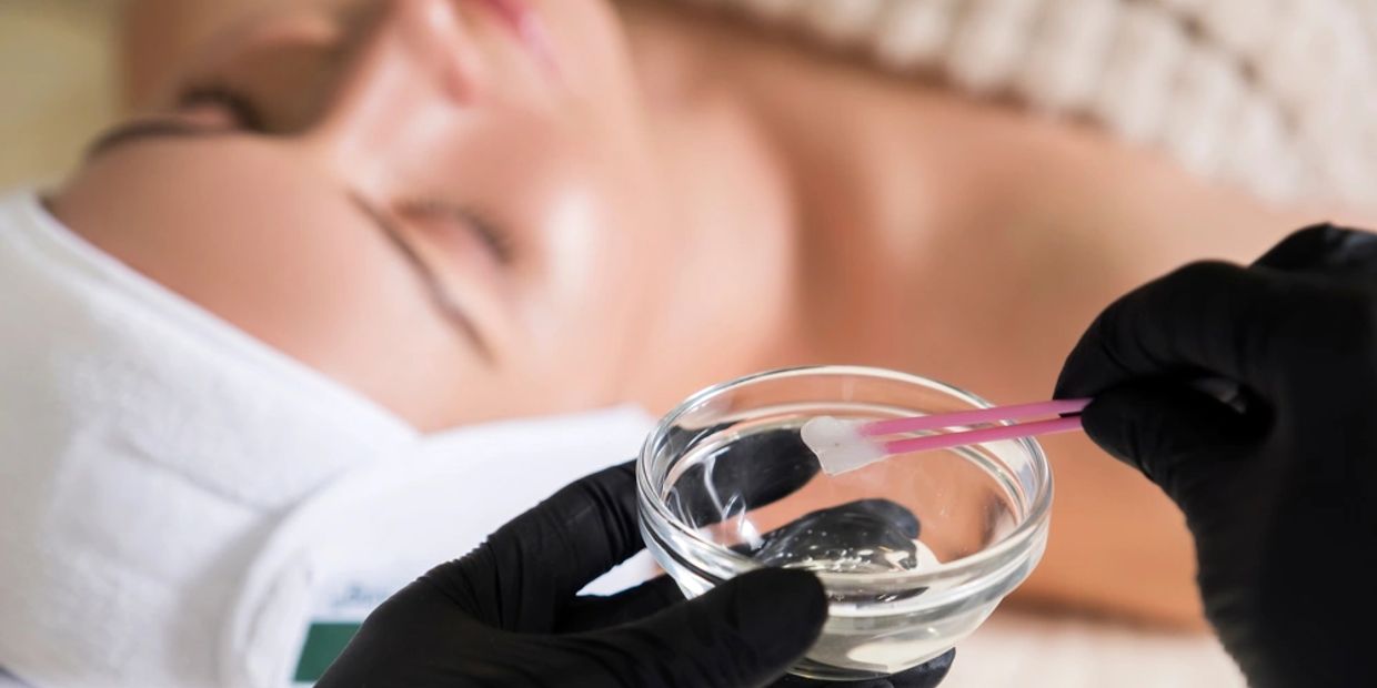 CHEMICAL PEELS SPA SPA FACIALS DEEP SKIN FACIALS 