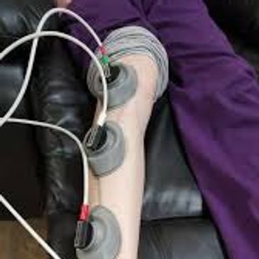 Revolutionizing Electrotherapy for Neuropathy and Chronic Pain