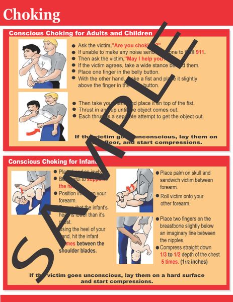 Choking Chart