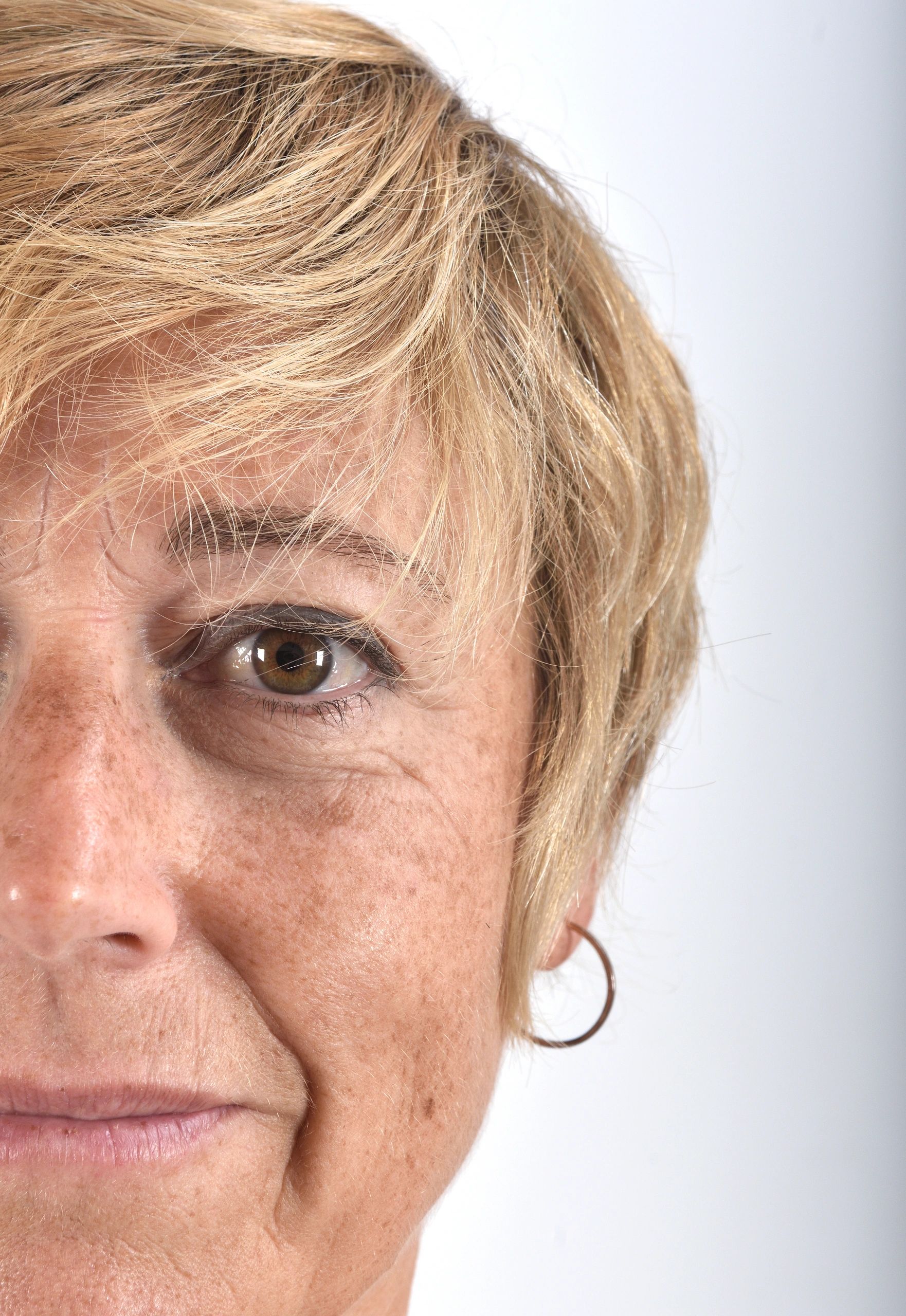 Manchas
Tratamiento para manchas
Facial
Melasma
Dra Monica Pineda