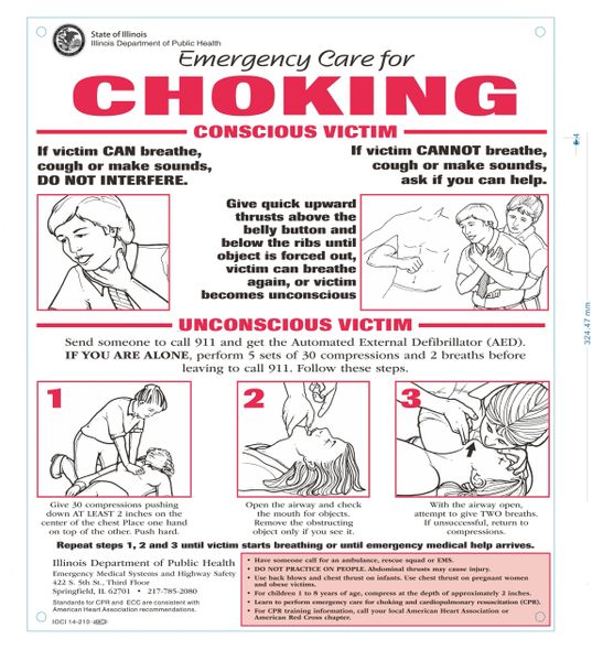 THE GUIDE ABOUT WHAT TO DO IN CASE OF CHOKING (ALUMINUM SIGNS 13X11)