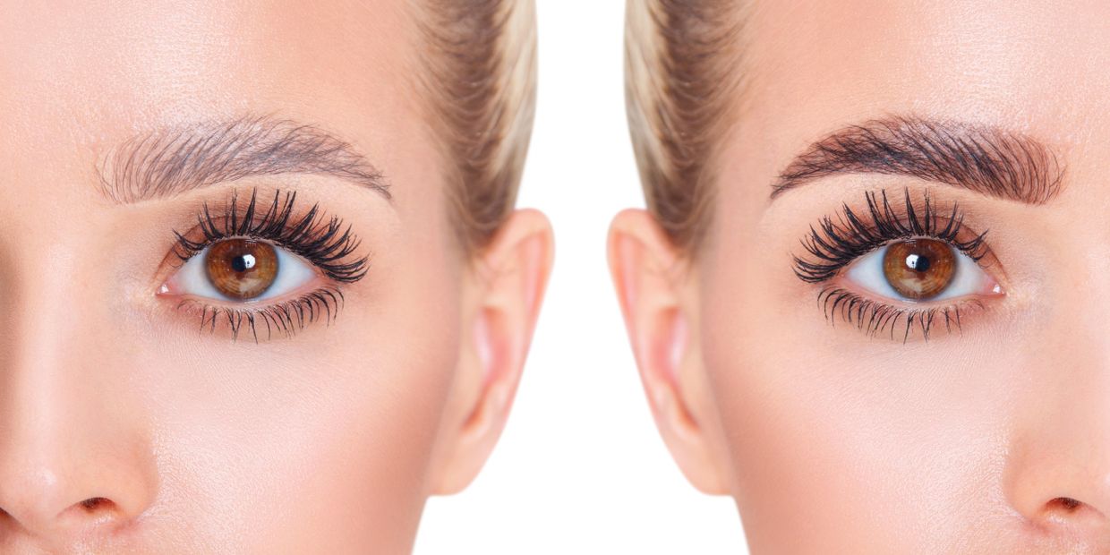 A young woman has a before and after photo following a Brow Lamination treatment. 