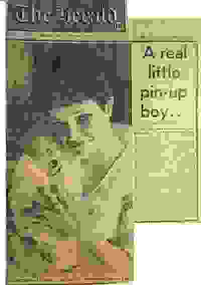 labour Treatment Dr Justin Lim Dr Selina Lim Professor Yoland Lim Health Care Laser JUVEFACE birth