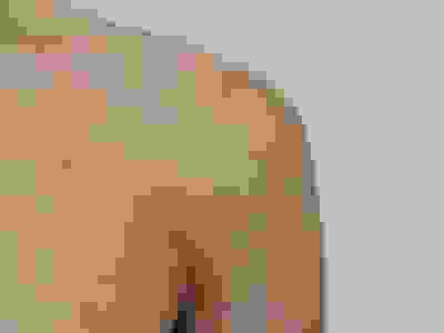 Treatment Dr Justin Lim Dr Selina Lim Professor Yoland Lim Health Care Laser JUVEFACE skin shoulder