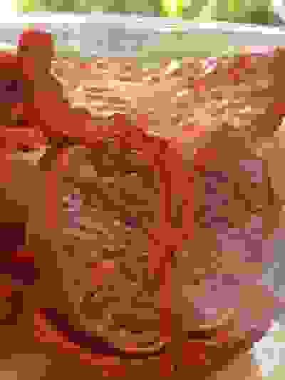 BPH Skin Treatment Dr Justin Lim Dr Selina Lim Professor Yoland Lim Health Care Laser JUVEFACE skin