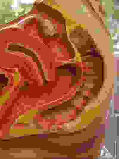 Gastro Treatment Dr Justin Lim Dr Selina Lim Professor Yoland Lim Health Care Laser JUVEFACE 