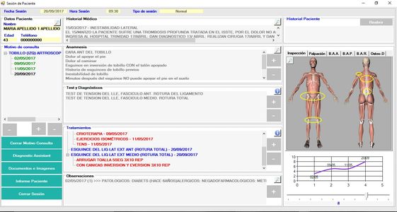 Historia clínica software fisiodiagnostic, puede ver el motivo de consulta, anamnesis, tests, diagnósticos, tratamientos, informe del paciente, historial médico, balance articular, lesiones osteopáticas,... 