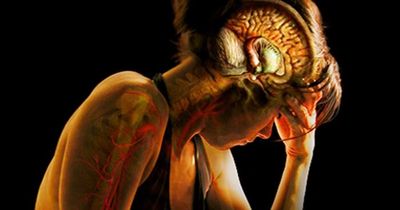 Headaches, Parkinson's, Multiple Sclerosis