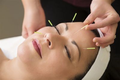 Akupunktur Tedavisi 