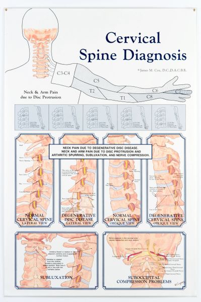 Cervical Spine Diagnosis (Neck and Arm Pain) (2'x3') - #24