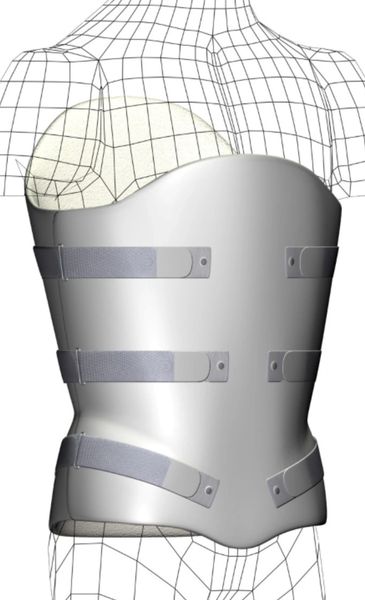 Star Brace® Corset TLSO