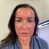 Same Day Powder brow and Microneedling