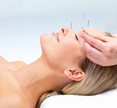 Acupuncture Therapy