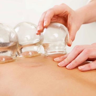 Dry Cupping Therapy