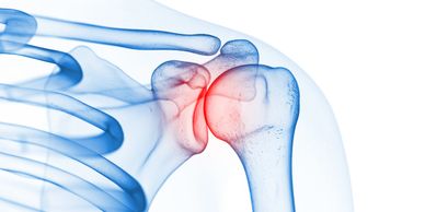 Shoulder surgeon gold coast