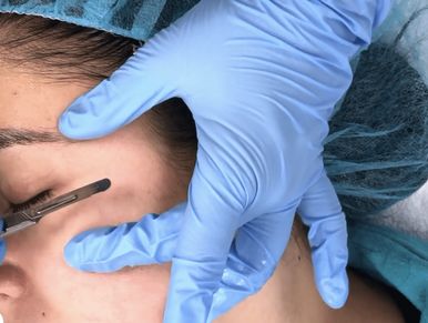 Dermaplaning is being performed on a woman. 