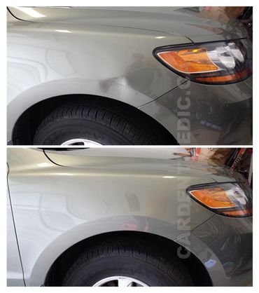 Front fender paintless dent removal.