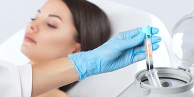 PRP,  Platelet-rich plasma, thread lifts, PDO monos, botox, filler, cosmetic injection, IV infusions