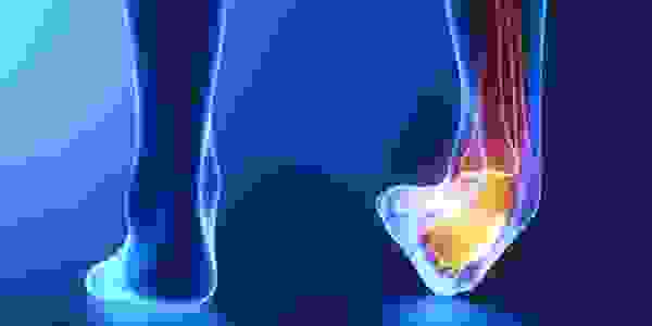 image72