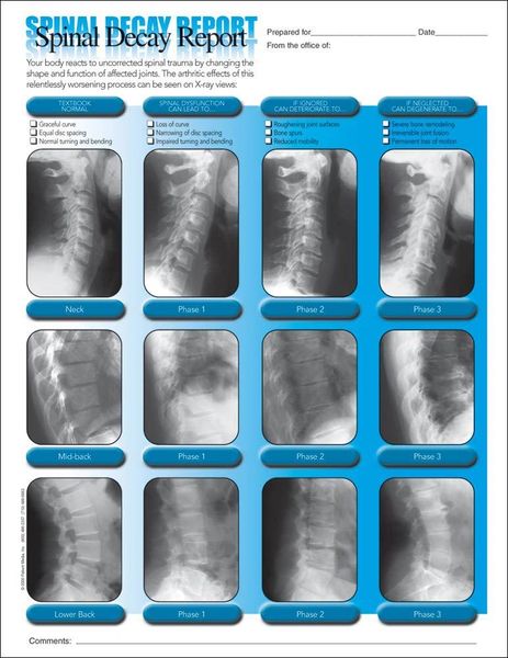 Spinal Decay Insert (50 A4 Sheets)